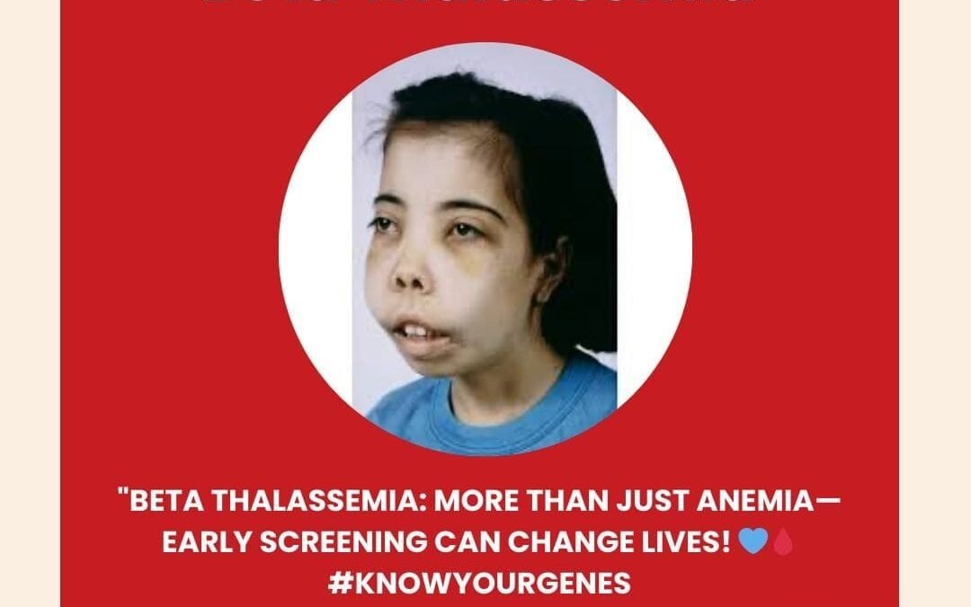 Thalassemia – Treatment in India – What Patients, Parents and Caregivers should know
