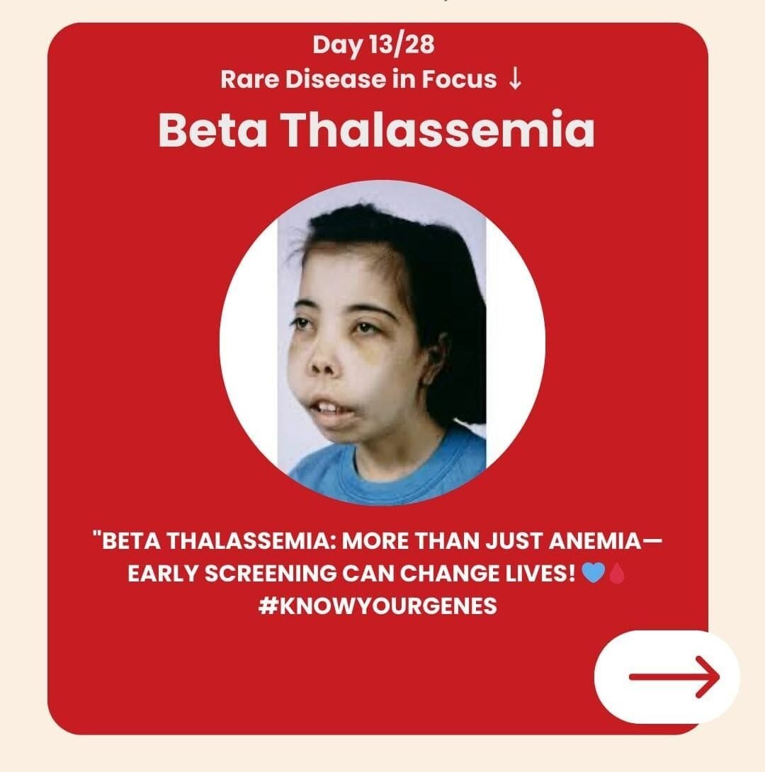 Genetidoc-Genetic-Clinic-and-DNA-Testing-Lab-Department-of-Genetic-Rare-Diseases-beta-thalassemia Genetidoc-Genetic-Clinic-and-DNA-Testing-Lab-Department-of-Genetic-Rare-Diseases-beta-thalassemia