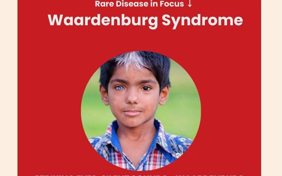 Day 17 of 28 Days, 28 Rare Diseases – Understanding Waardenburg Syndrome