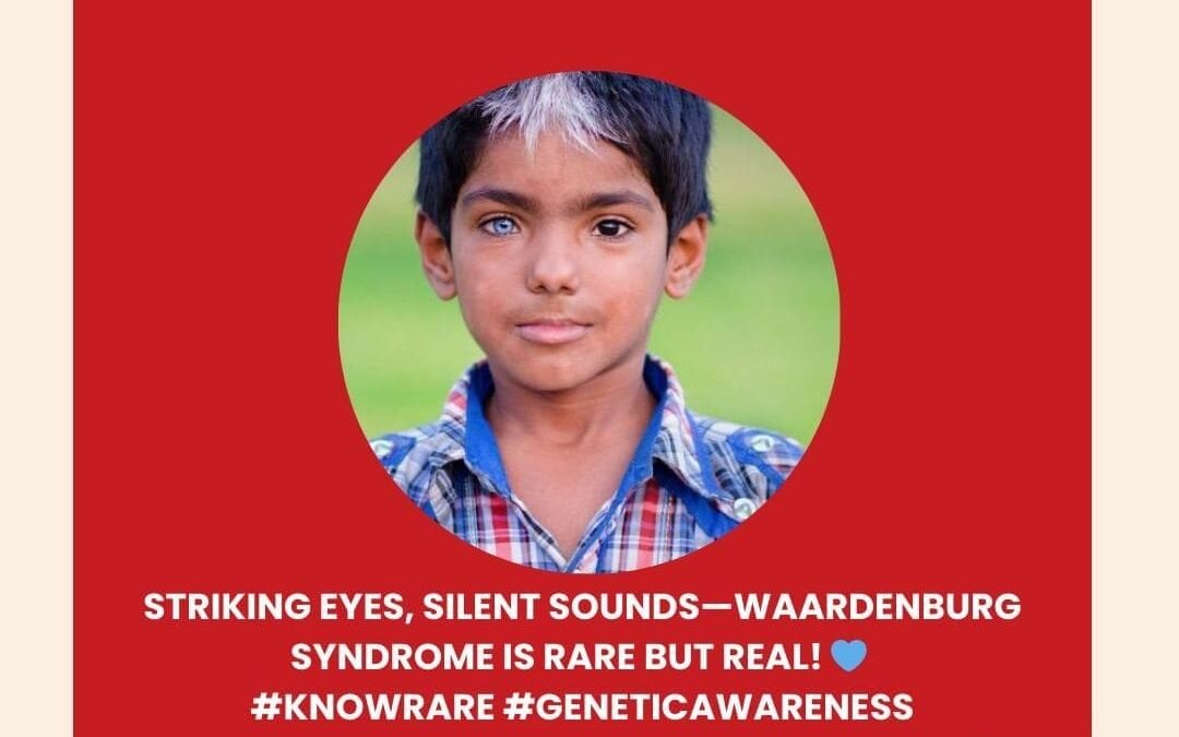 Waardenburg Syndrome – Treatment in India – What Patients, Parents and Caregivers should know