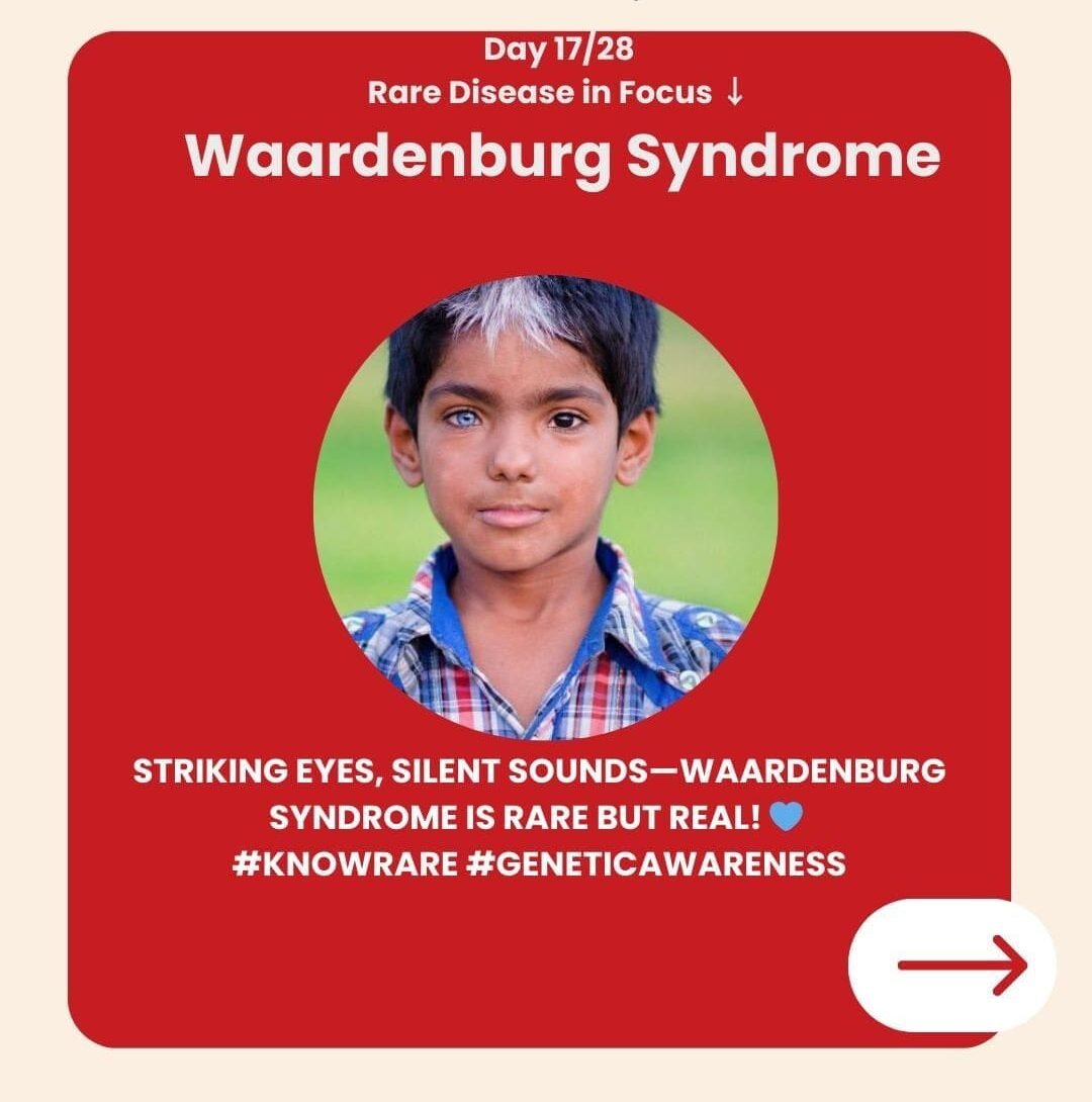 Genetidoc-Genetic-Clinic-and-DNA-Testing-Lab-India-Department-of-Genetic-Rare-Diseases-waardenburg-syndrome