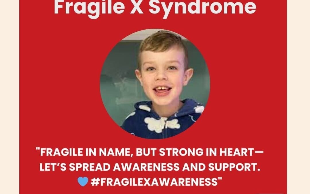 Fragile X Syndrome – Treatment in India – What Parents and Caregivers should know