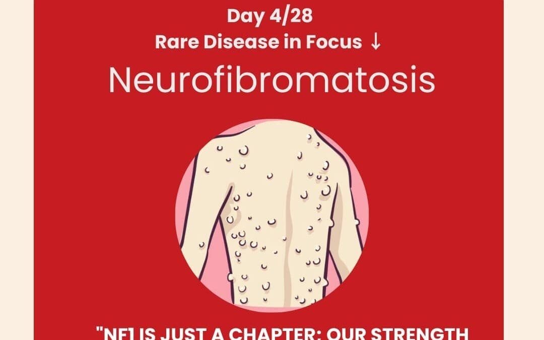 Day 4 of 28 Days, 28 Rare Diseases – Understanding Neurofibromatosis Type 1 (NF1) – February 4, 2025