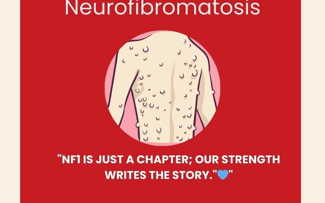 Neurofibromatosis Syndrome – Treatment in India – What Patients, Parents and Caregivers should know