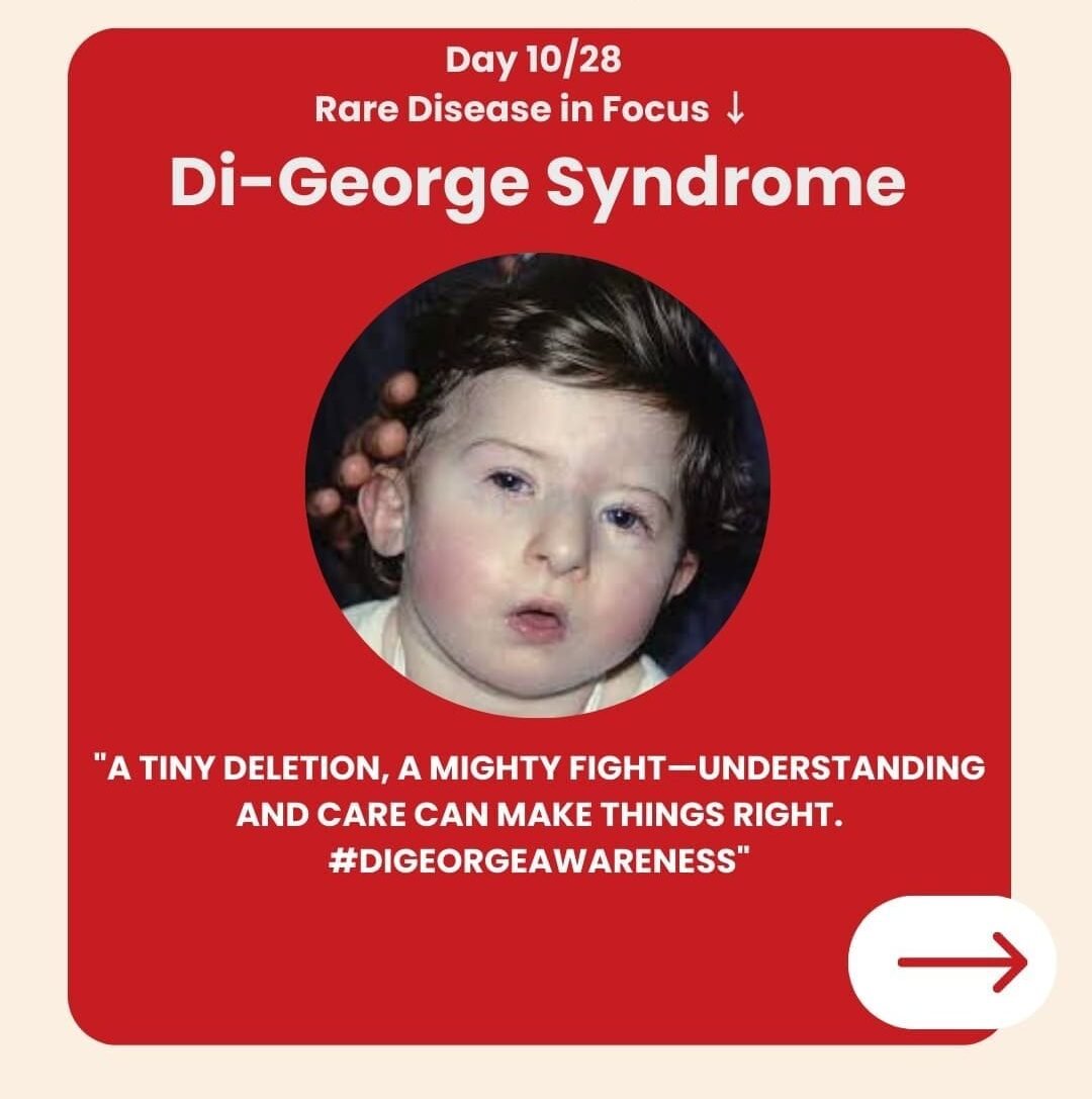 Genetidoc-Genetic-Clinic-and-DNA-Testing-Lab-Department-of-Genetic-Rare-Diseases-DiGeorge-syndrome-DGS