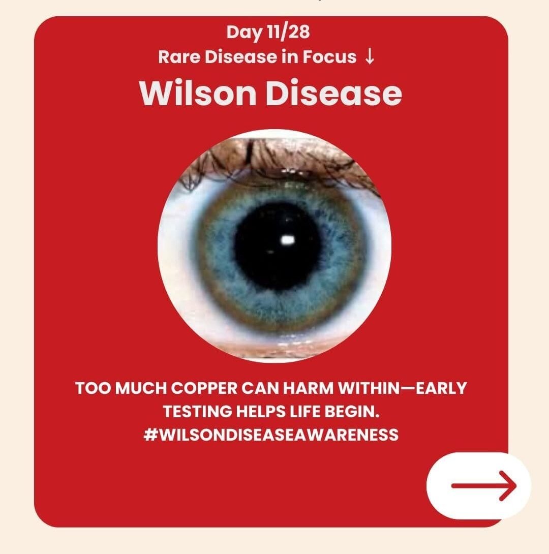 Genetidoc-Genetic-Clinic-and-DNA-Testing-Lab-Department-of-Genetic-Rare-Diseases-Wilson's-Disease
