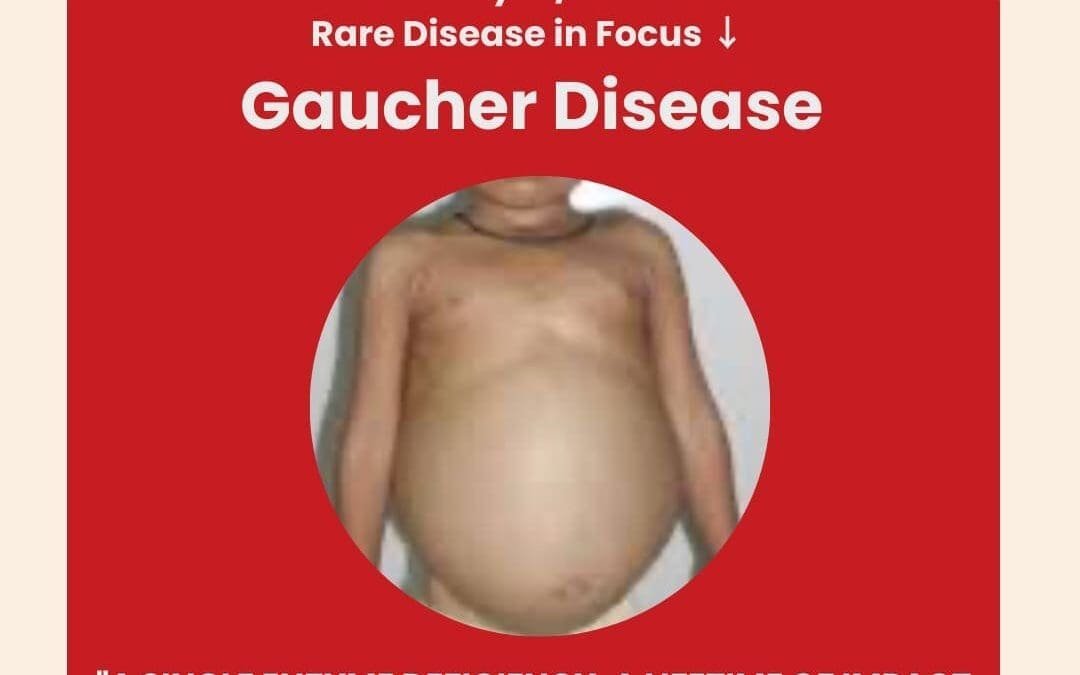 Day 12 of 28 Days, 28 Rare Diseases – Understanding Gaucher Disease