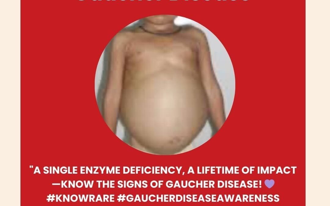Gaucher Disease – Treatment in India – What Patients, Parents and Caregivers should know