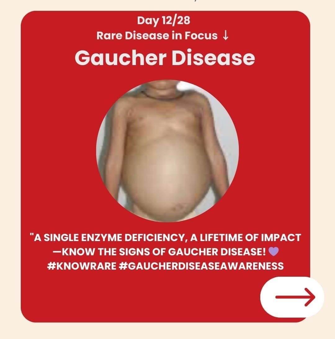 Genetidoc-Genetic-Clinic-and-DNA-Testing-Lab-Department-of-Genetic-Rare-Diseases-gaucher-disease Genetidoc-Genetic-Clinic-and-DNA-Testing-Lab-Department-of-Genetic-Rare-Diseases-gaucher-disease