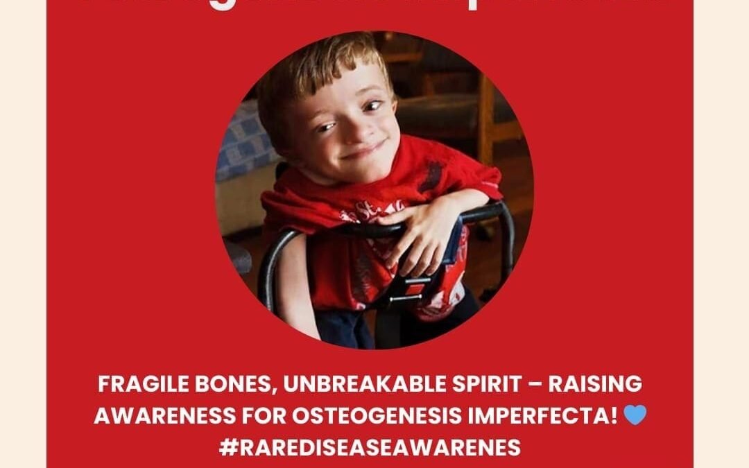 Osteogenesis Imperfecta – Treatment in India – What Patients, Parents and Caregivers should know