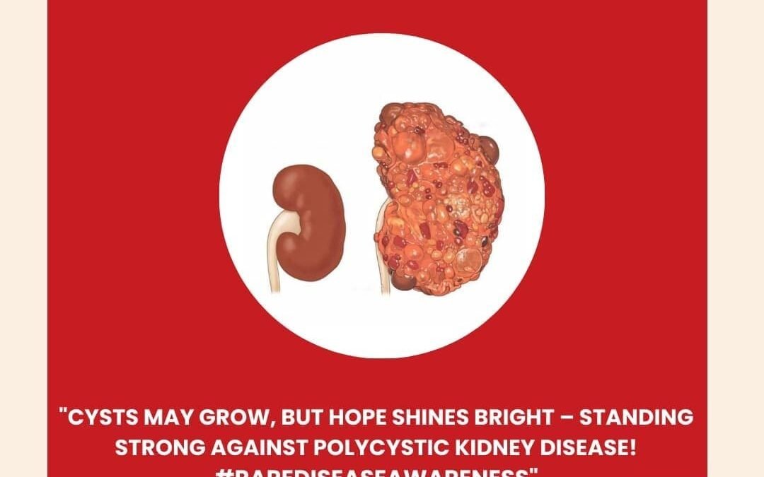 Polycystic Kidney Disease – Treatment in India – What Patients, Parents and Caregivers should know
