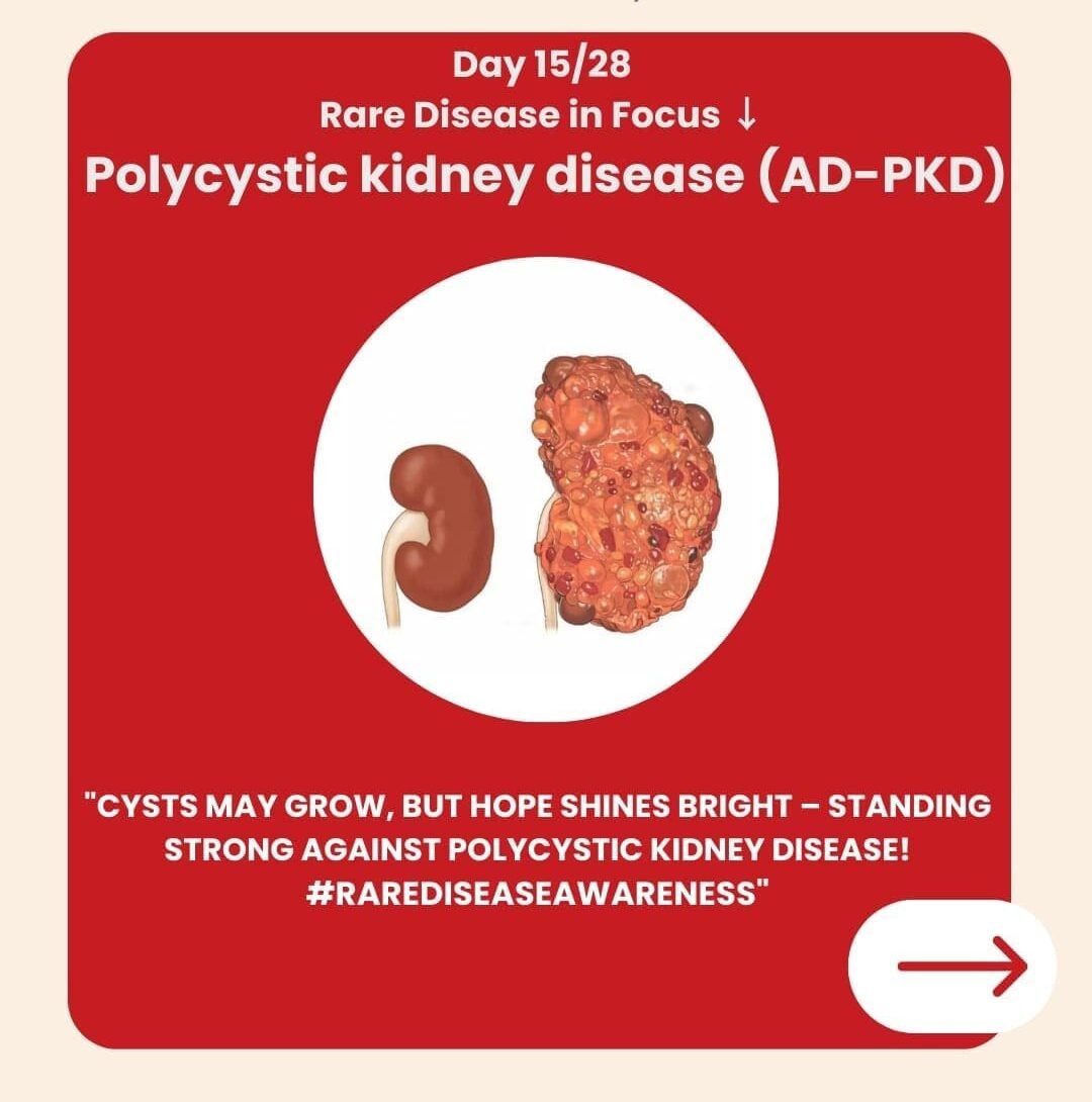 Genetidoc-Genetic-Clinic-and-DNA-Testing-Lab-Department-of-Genetic-Rare-Diseases-polycystic-kidney-disease