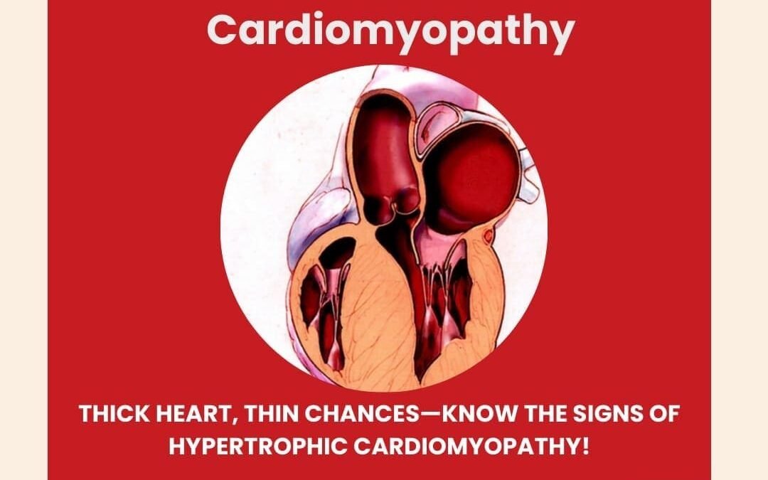 Inherited Cardiomyopathy – Treatment in India – What Patients, Parents and Caregivers should know
