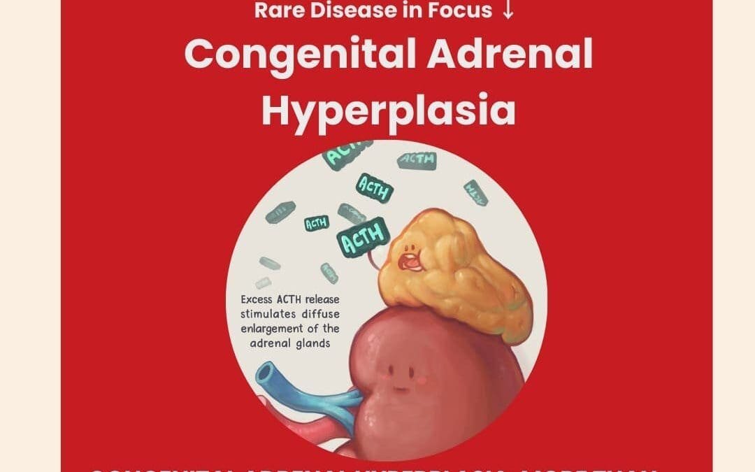 Day 18 of 28 Days, 28 Rare Diseases – Understanding Congenital Adrenal Hyperplasia
