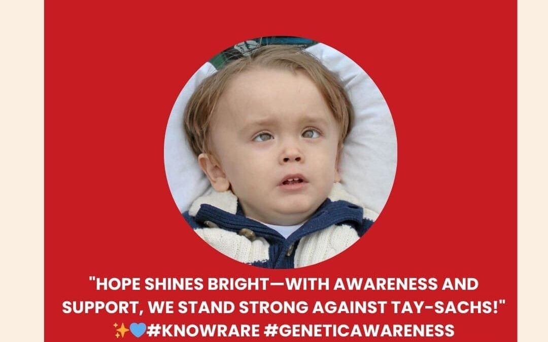 Tay Sach’s Disease (GM2 Gangliosidosis) – Treatment in India – What Patients, Parents and Caregivers should know