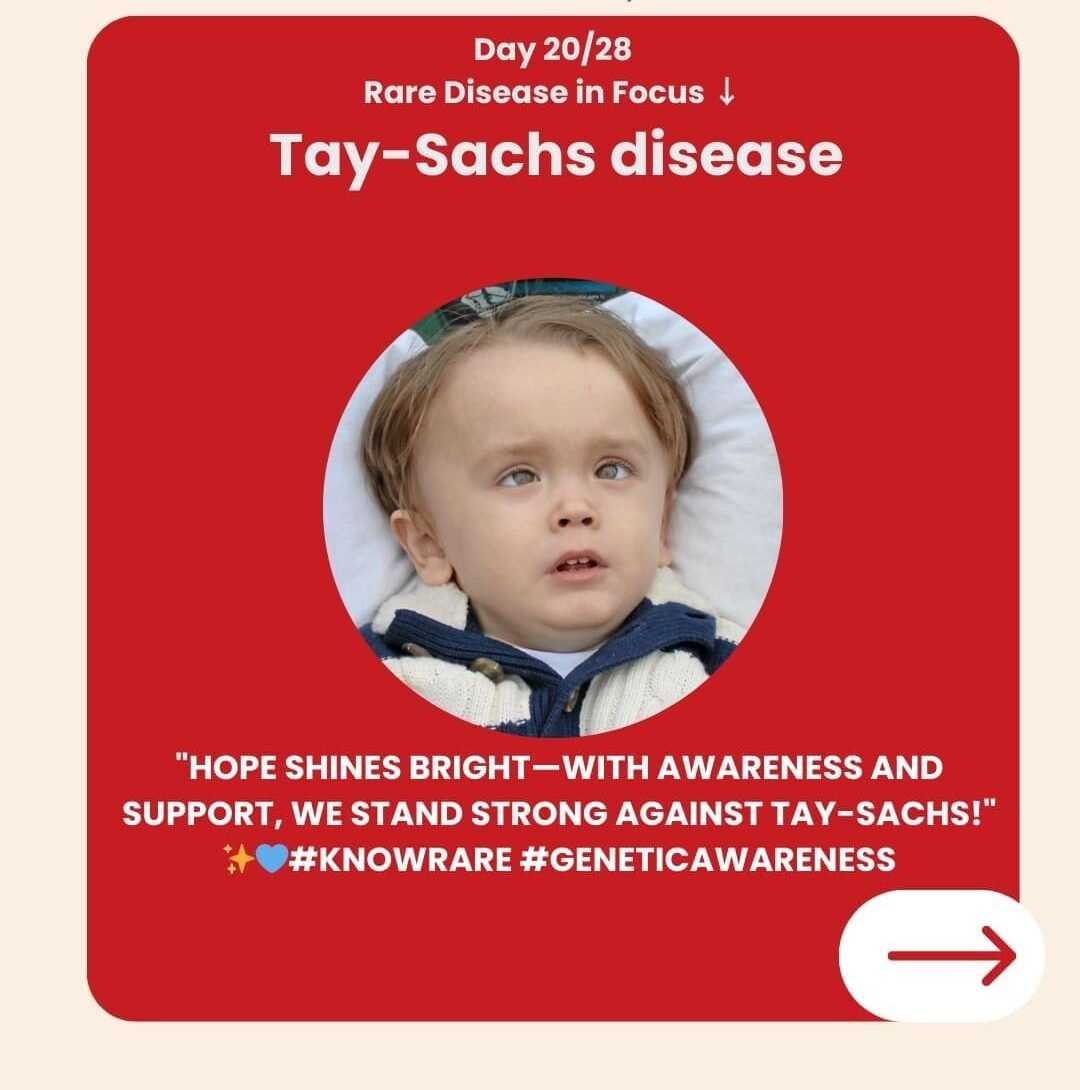 Genetidoc-Genetic-Clinic-and-DNA-Testing-Lab-India-Department-of-Genetic-Rare-Diseases-tay-sachs-disease-gm2-gangliosidosis Genetidoc-Genetic-Clinic-and-DNA-Testing-Lab-India-Department-of-Genetic-Rare-Diseases-tay-sachs-disease-gm2-gangliosidosis