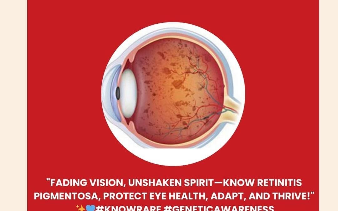 Genetidoc-Genetic-Clinic-and-DNA-Testing-Lab-India-Department-of-Genetic-Rare-Diseases-retinitis-pigmentosa