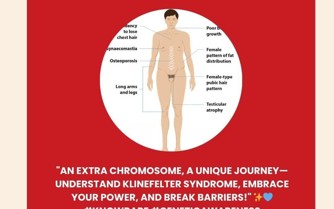 Genetidoc-Genetic-Clinic-and-DNA-Testing-Lab-India-Department-of-Genetic-Rare-Diseases-klinefelter-syndrome