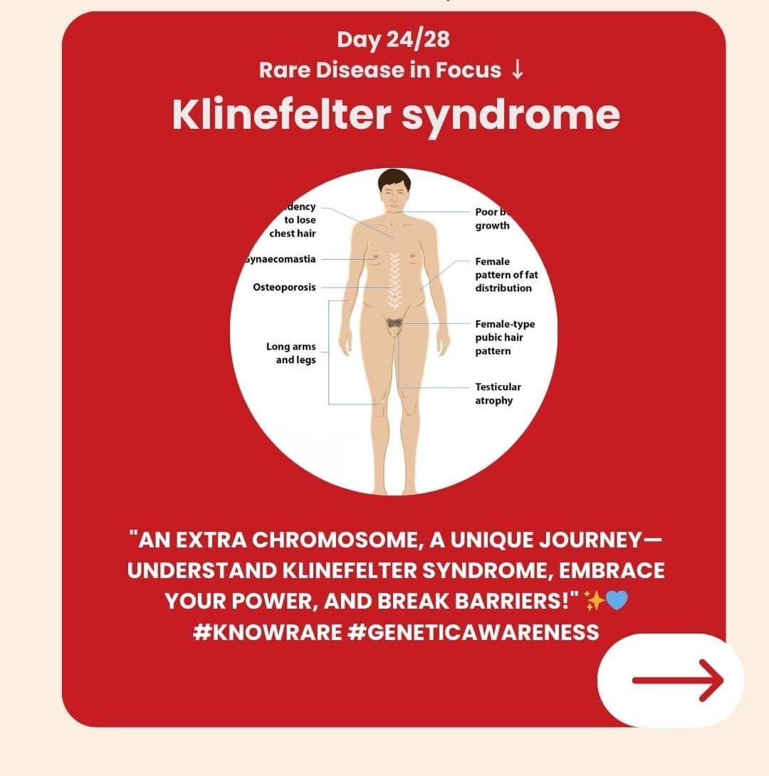 Genetidoc-Genetic-Clinic-and-DNA-Testing-Lab-India-Department-of-Genetic-Rare-Diseases-klinefelter-syndrome