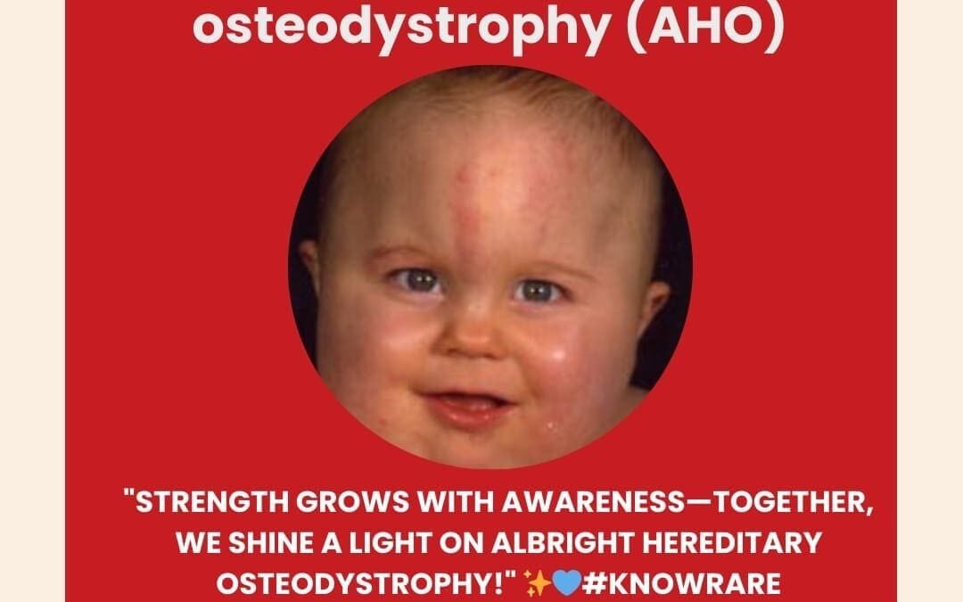 Genetidoc-Genetic-Clinic-and-DNA-Testing-Lab-India-Department-of-Genetic-Rare-Diseases-albright's-hereditary-osteodystrophy
