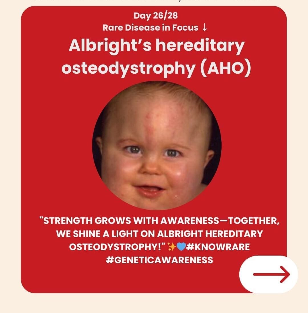 Genetidoc-Genetic-Clinic-and-DNA-Testing-Lab-India-Department-of-Genetic-Rare-Diseases-albright's-hereditary-osteodystrophy