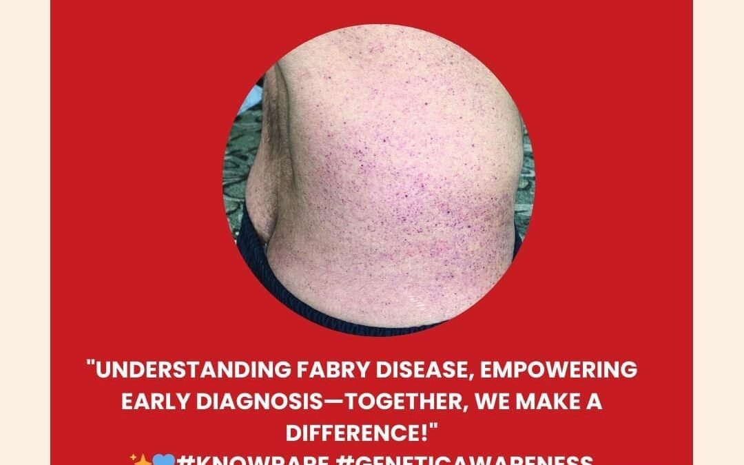 Genetidoc-Genetic-Clinic-and-DNA-Testing-Lab-India-Department-of-Genetic-Rare-Diseases-fabry-disease