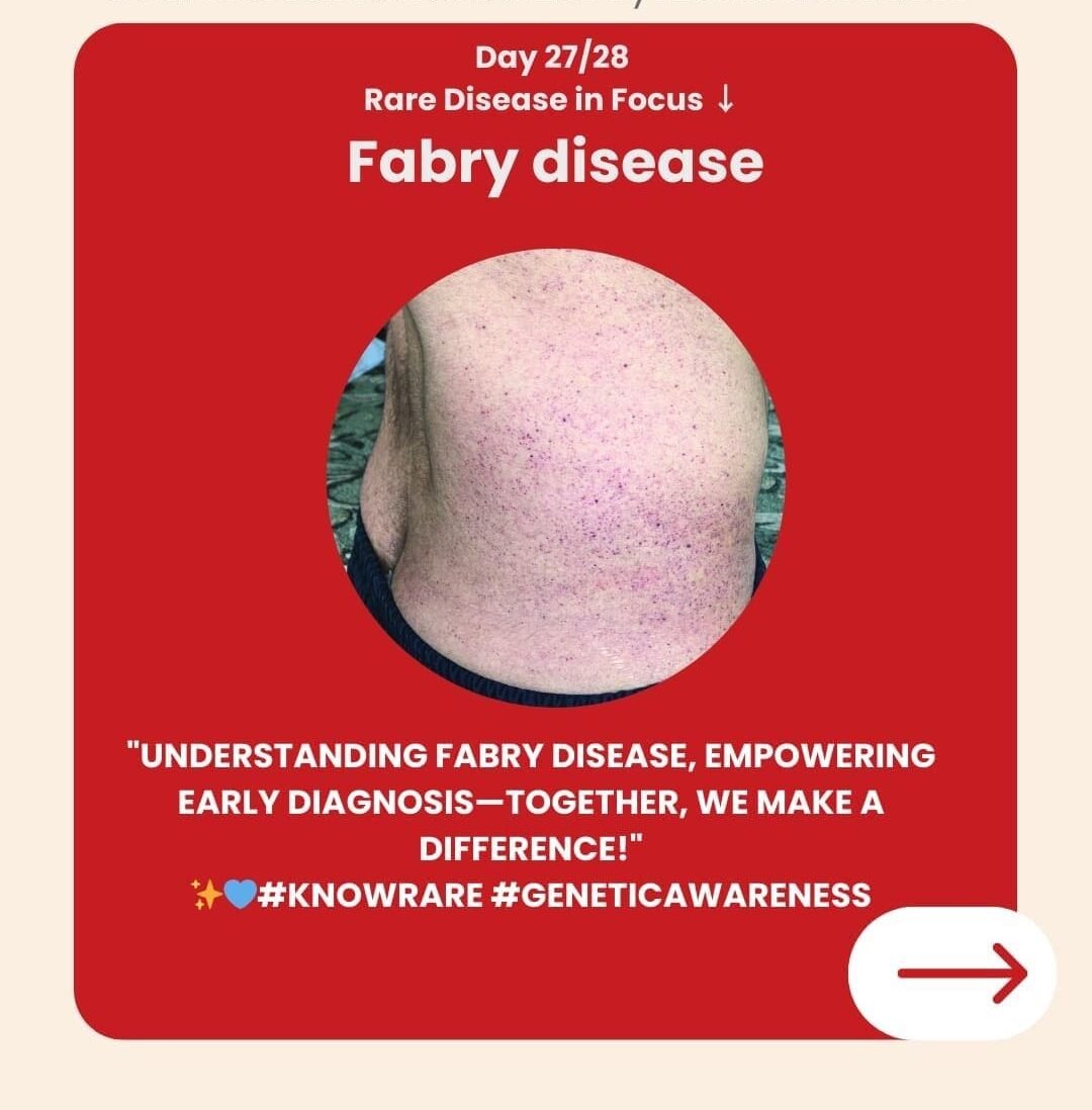 Genetidoc-Genetic-Clinic-and-DNA-Testing-Lab-India-Department-of-Genetic-Rare-Diseases-fabry-disease