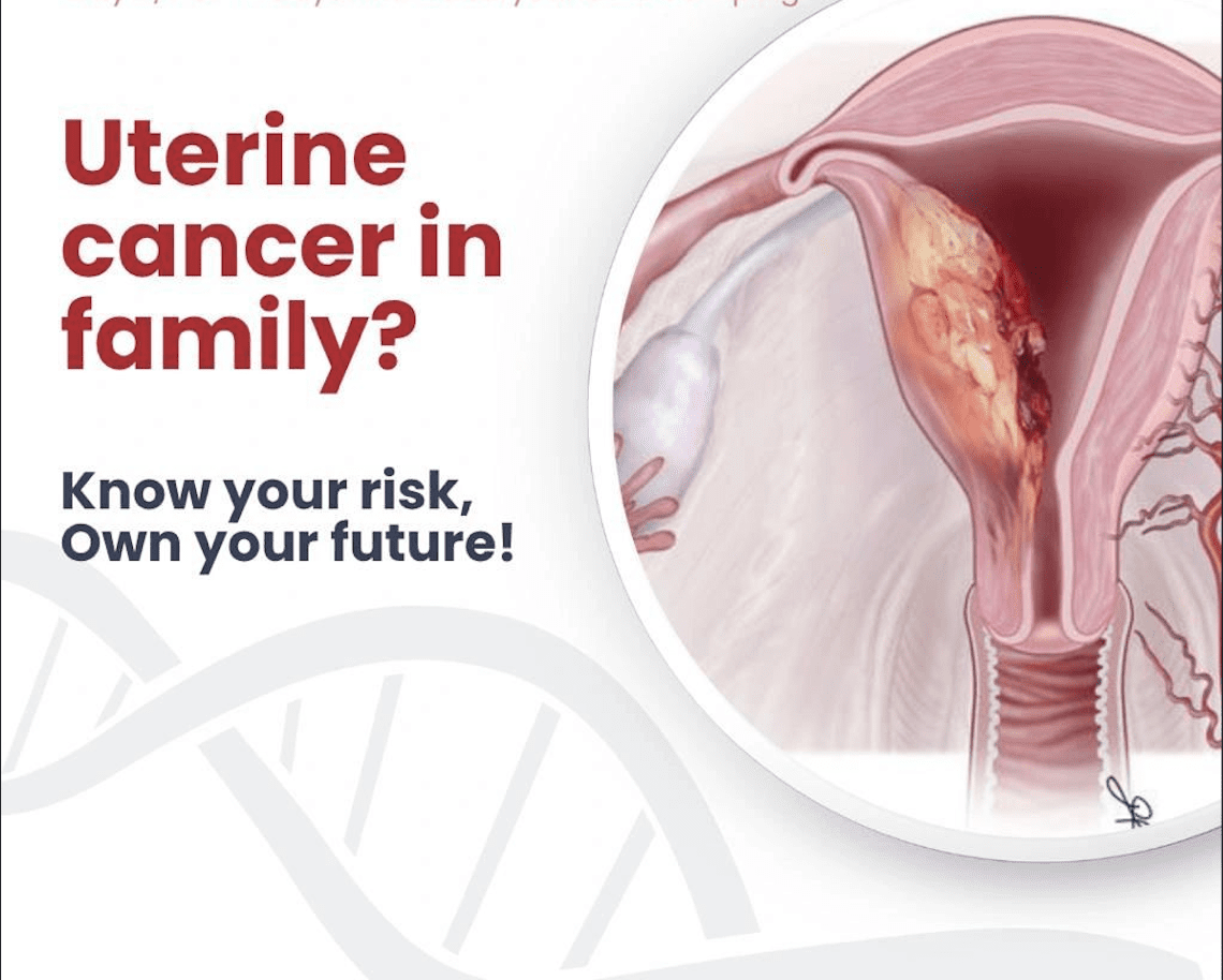 cancer uterus - carcinoma endometrium - genetidoc Genetic clinic and DNA testing lab