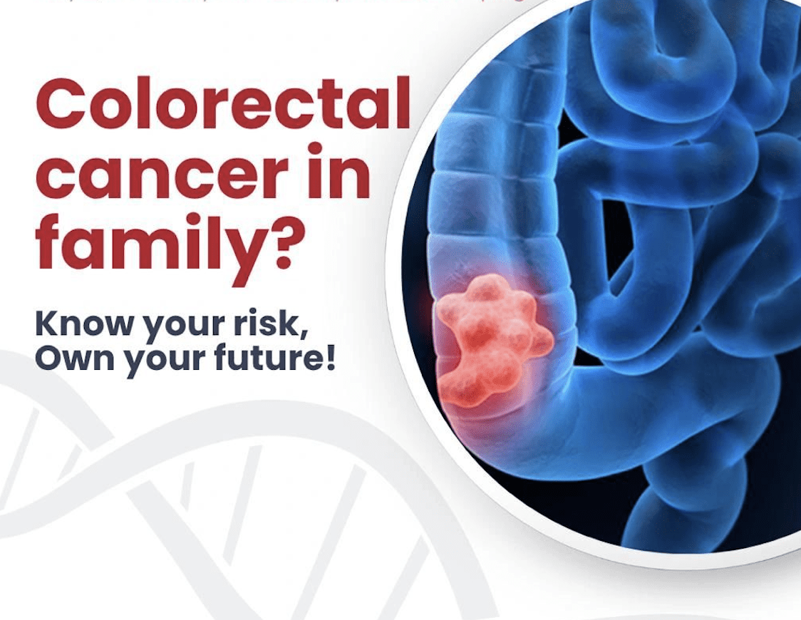 cancer colon - carcinoma colorectal - genetidoc Genetic clinic and DNA testing lab