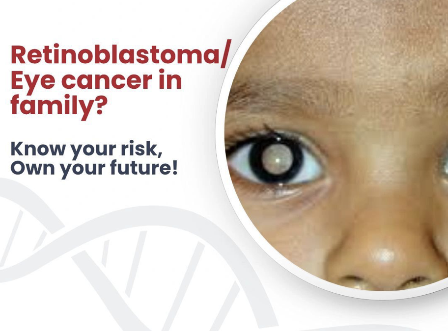 eye cancer - retinoblastoma - genetidoc Genetic clinic and DNA testing lab