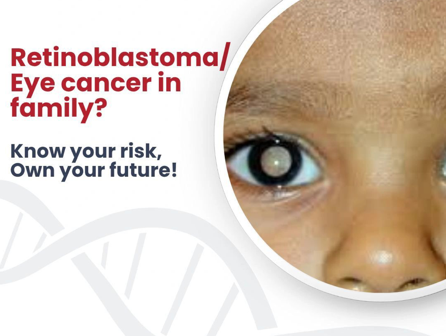 eye cancer – retinoblastoma – genetidoc Genetic clinic and DNA testing lab eye cancer - retinoblastoma - genetidoc Genetic clinic and DNA testing lab
