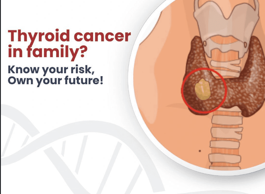 Thyroid cancer - genetidoc Genetic clinic and DNA testing lab