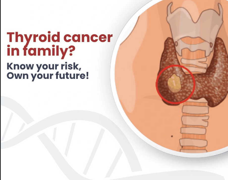 Thyroid cancer - genetidoc Genetic clinic and DNA testing lab