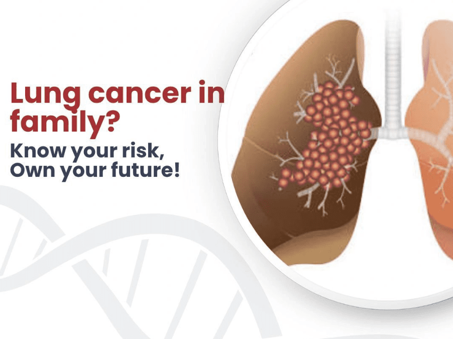lung cancer - genetidoc Genetic clinic and DNA testing lab