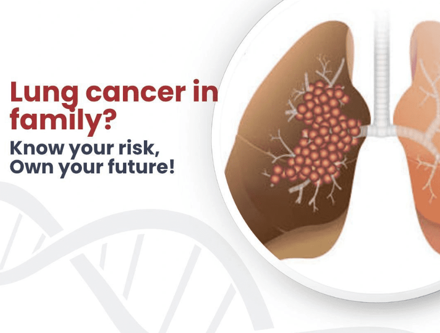 lung cancer - genetidoc Genetic clinic and DNA testing lab