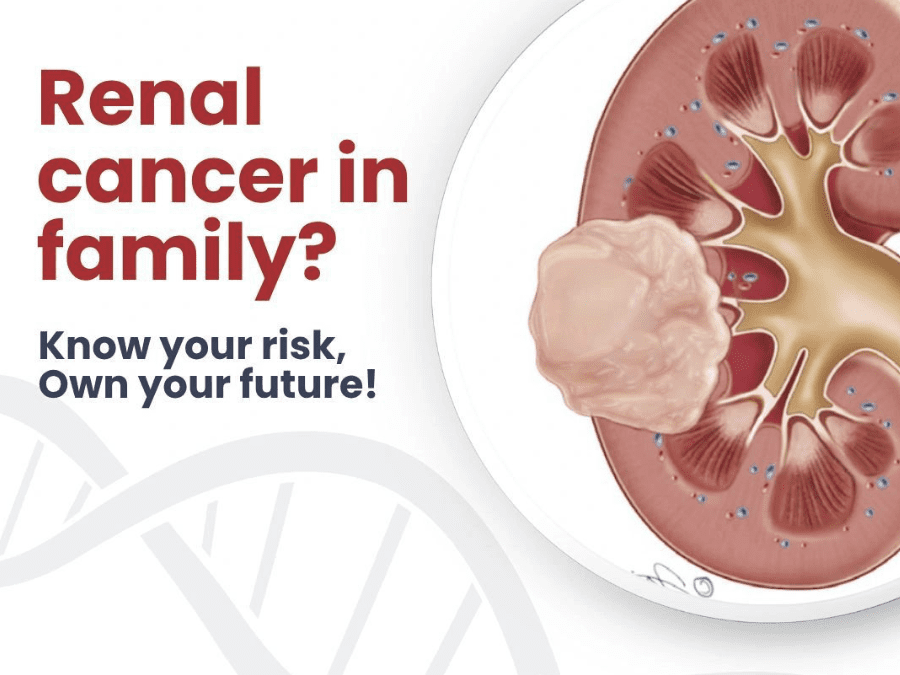 renal cancer - genetidoc Genetic clinic and DNA testing lab