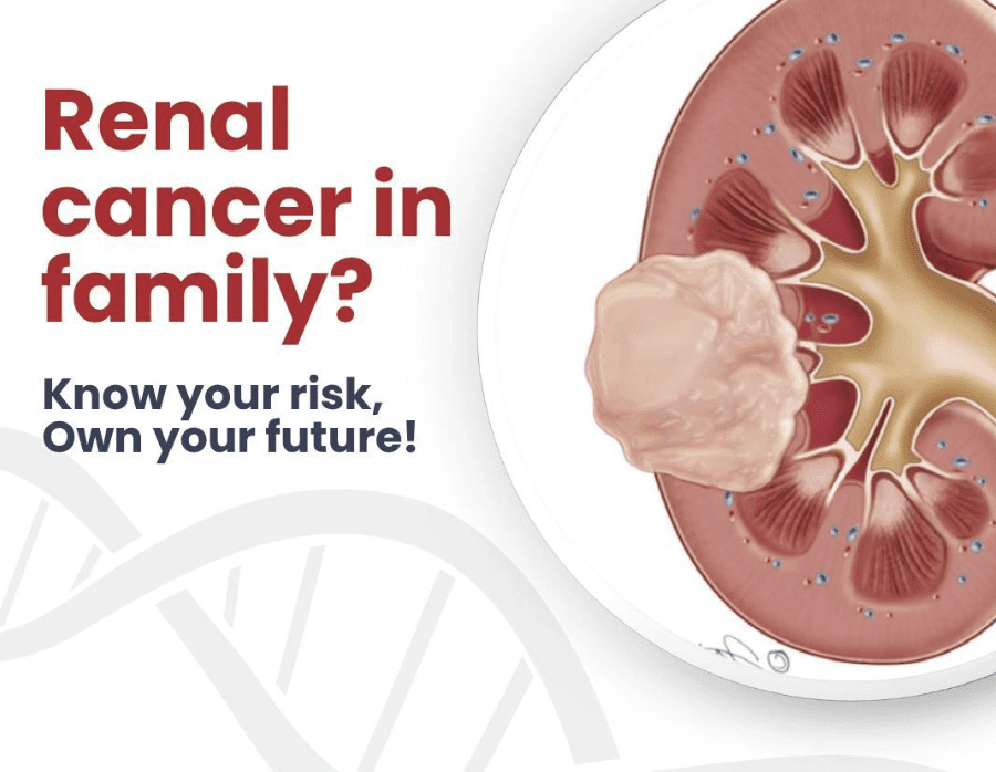renal cancer - genetidoc Genetic clinic and DNA testing lab