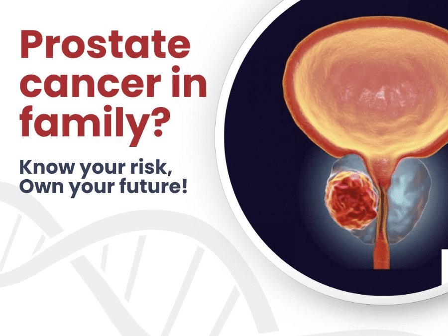 prostate cancer - genetidoc Genetic clinic and DNA testing lab