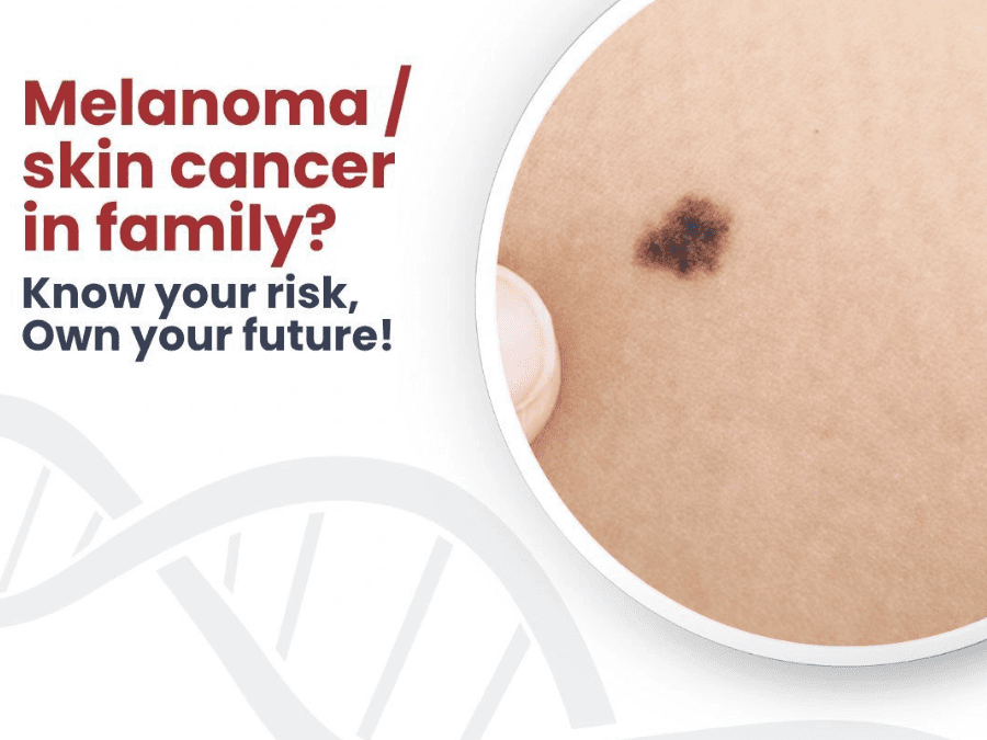 skin cancer - melanoma - genetidoc Genetic clinic and DNA testing lab
