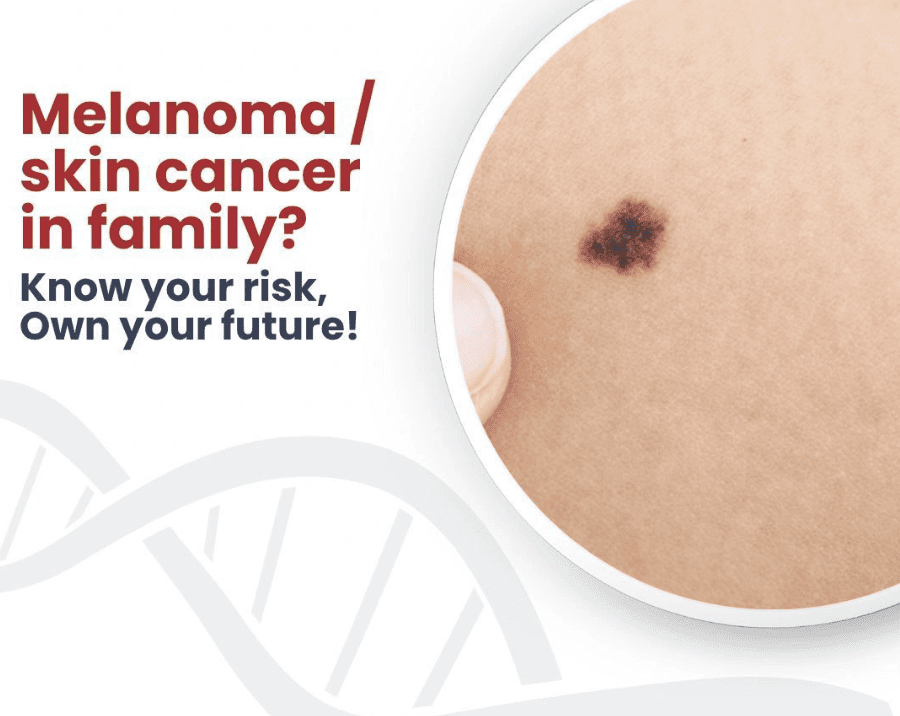 skin cancer - melanoma - genetidoc Genetic clinic and DNA testing lab